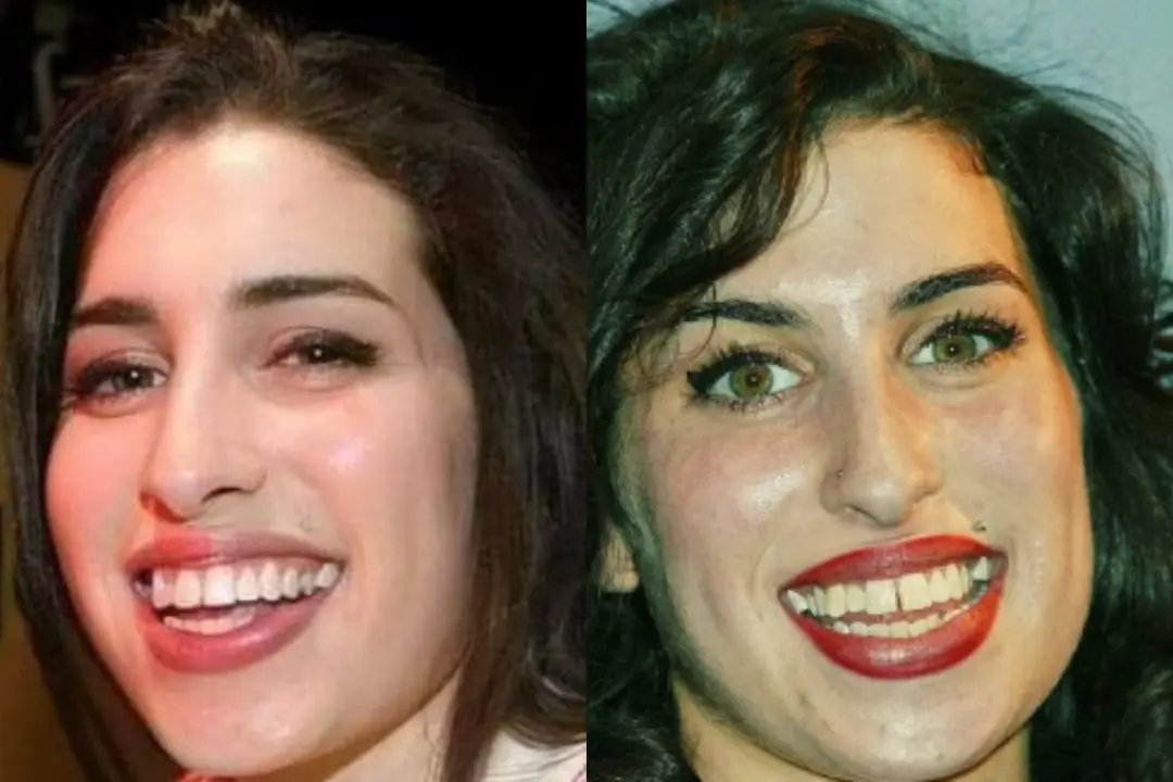 Amy Winehouse teeth