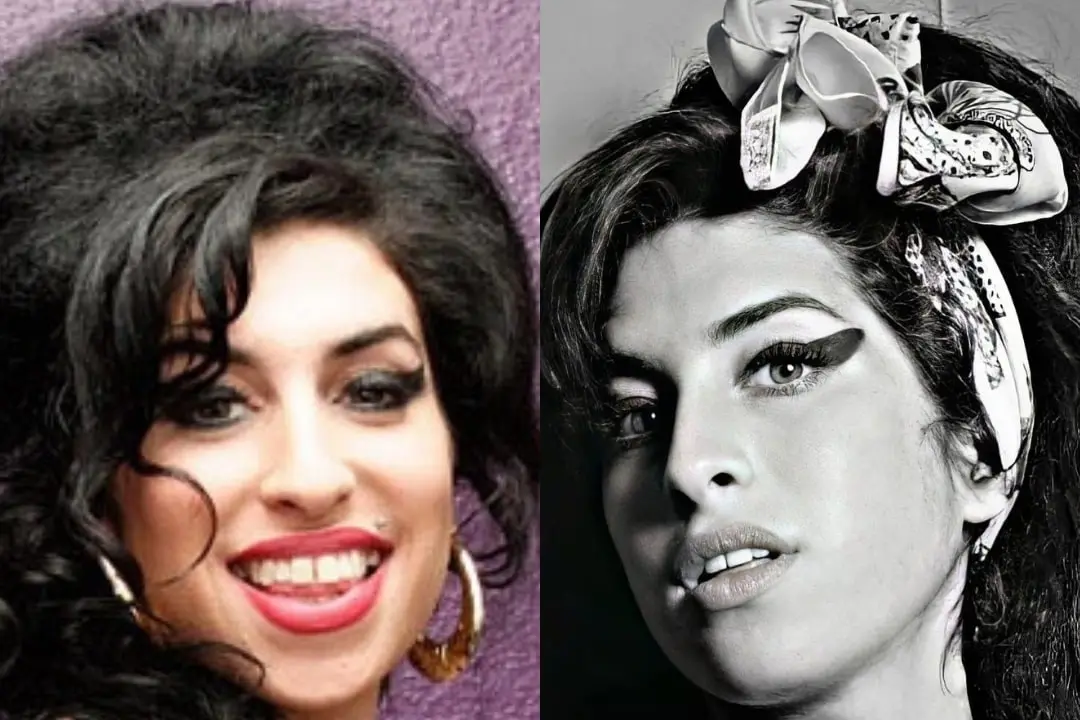 Dental implants before after Antalya, Turkey