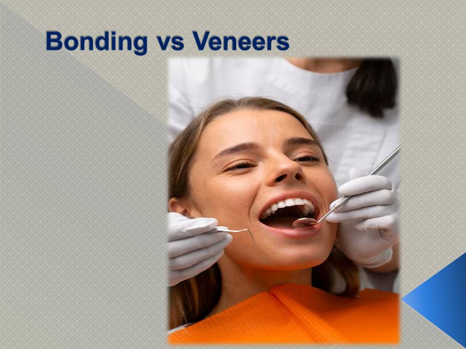 Composite vs Veneers Antalya Turkey