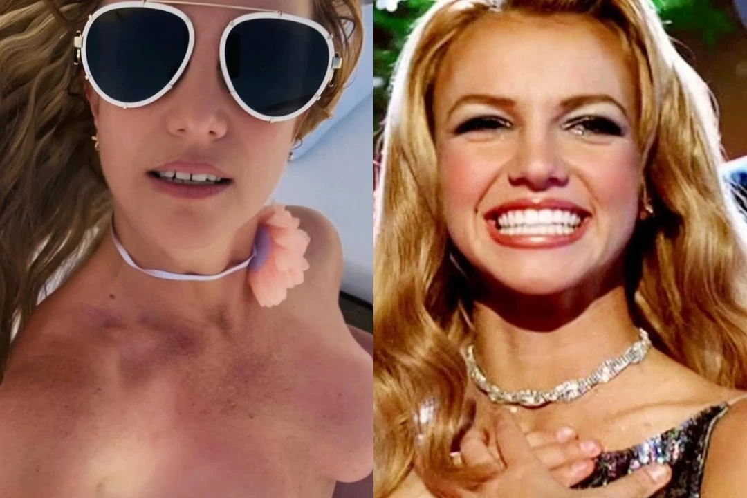 Britney Spears teeth before and after Britney Spears teeth before and after Antalya, Turkey