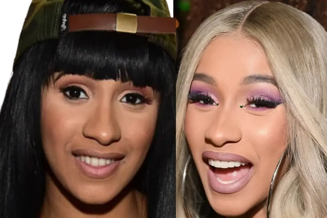 Cardi B teeth Antalya, Turkey