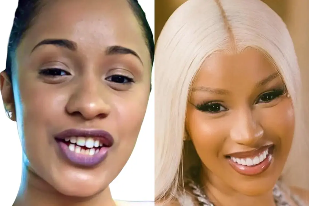 Cardi B teeth Antalya, Turkey