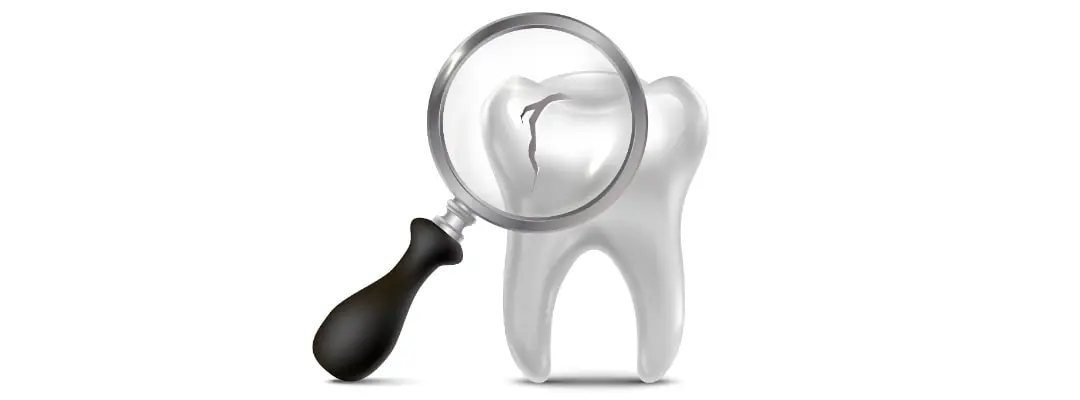What does a cracked tooth like? What does a cracked tooth like?