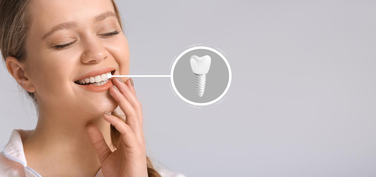 dental-implants-antalya-turkey-tooth-implant