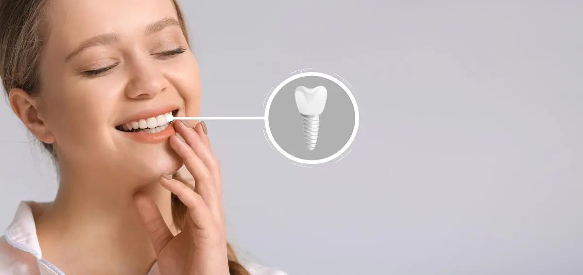 dental-implants-antalya-turkey-tooth-implant
