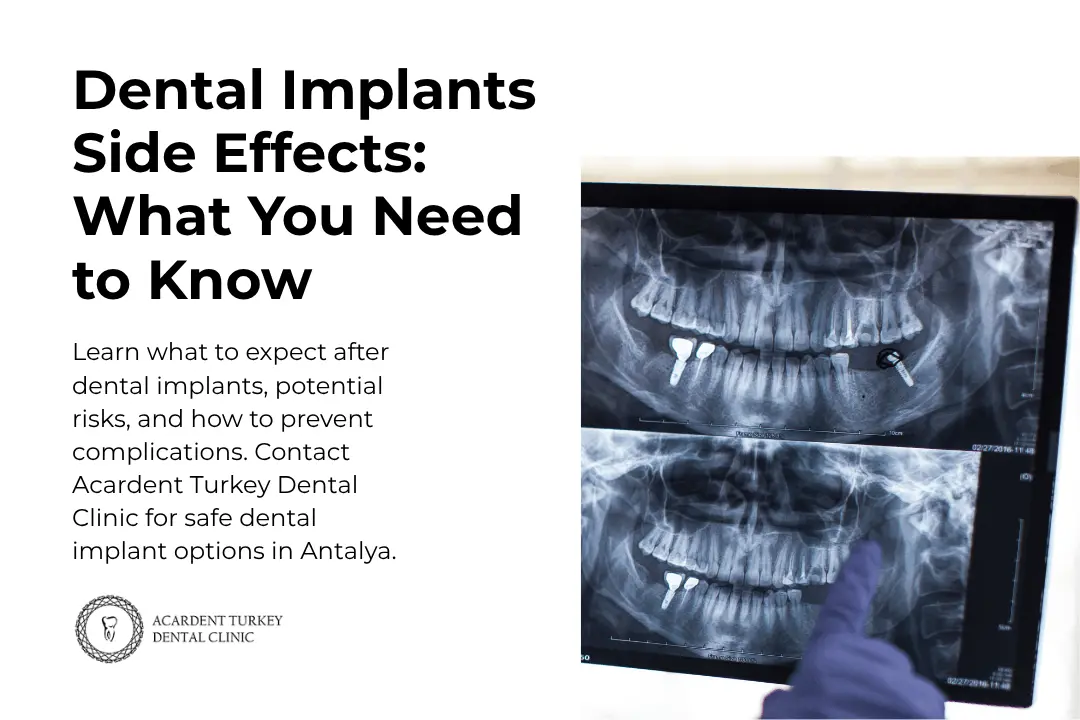 Dental Implants Side Effects: What You Need to Know