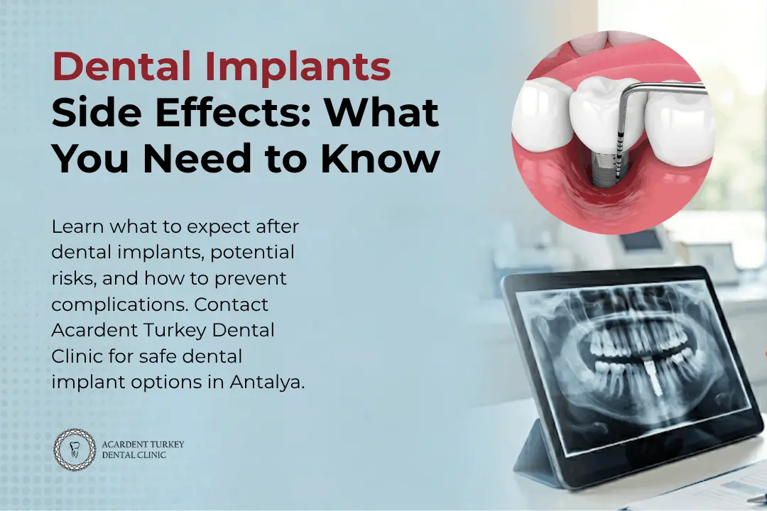Dental Implants Side Effects