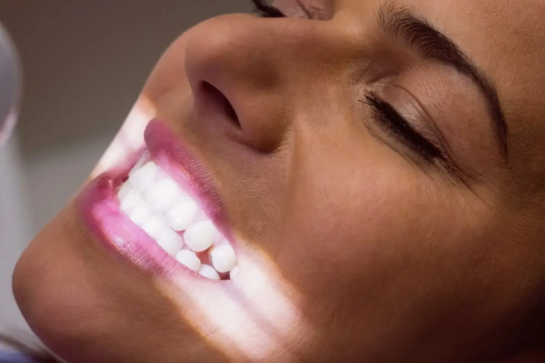 EMAX Veneers Pros and Cons EMAX Veneers Pros and Cons
