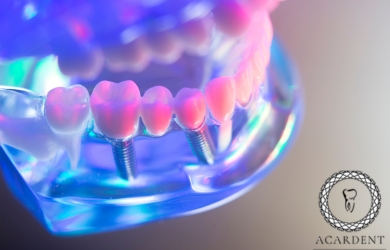  What is flapless dental implant treatment, Antalya