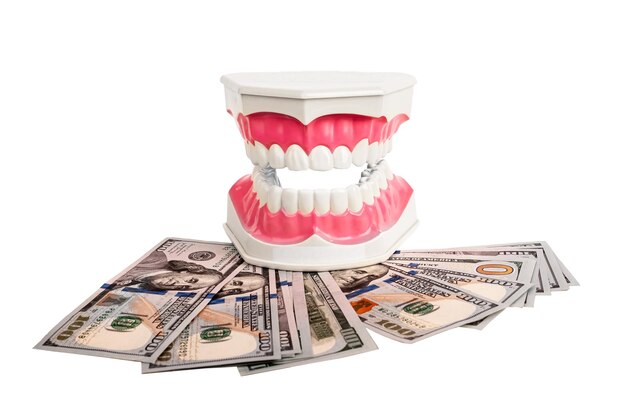 full-mouth-dental-implant-antalya-turkey-cost