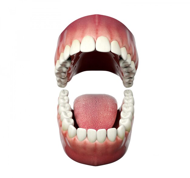 full-mouth-dental-implant-antalya-turkey