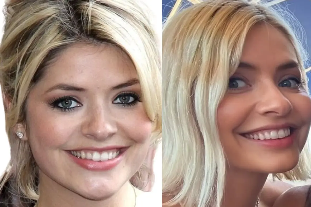 Holly Willoughby teeth Antalya, Turkey