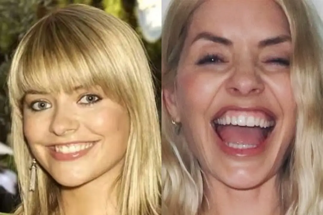 Holly Willoughby teeth Antalya, Turkey
