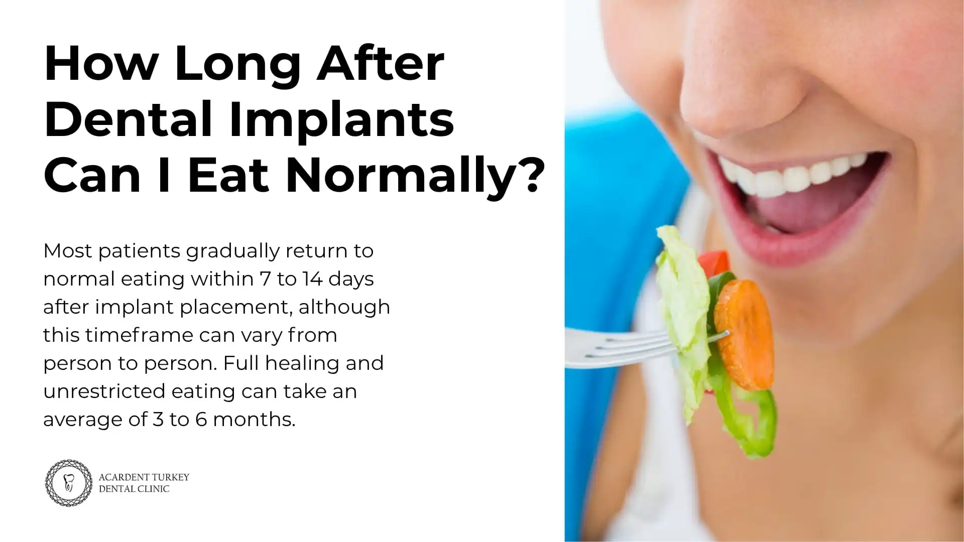 How Long After Dental Implants in Turkey Can I Eat Normally?