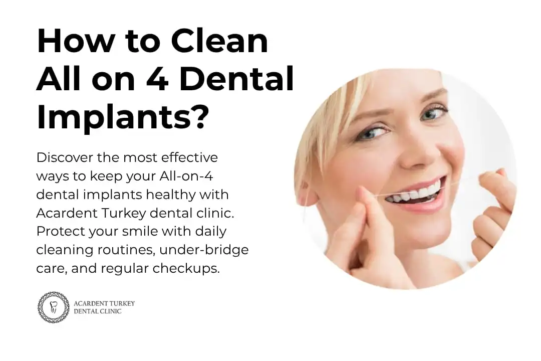 How to Clean All on 4 Dental Implants? - Acardent Turkey Clinic