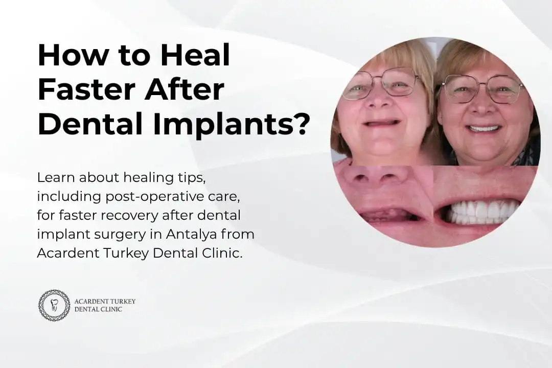 How to heal faster after dental implants? Antalya, Turkey