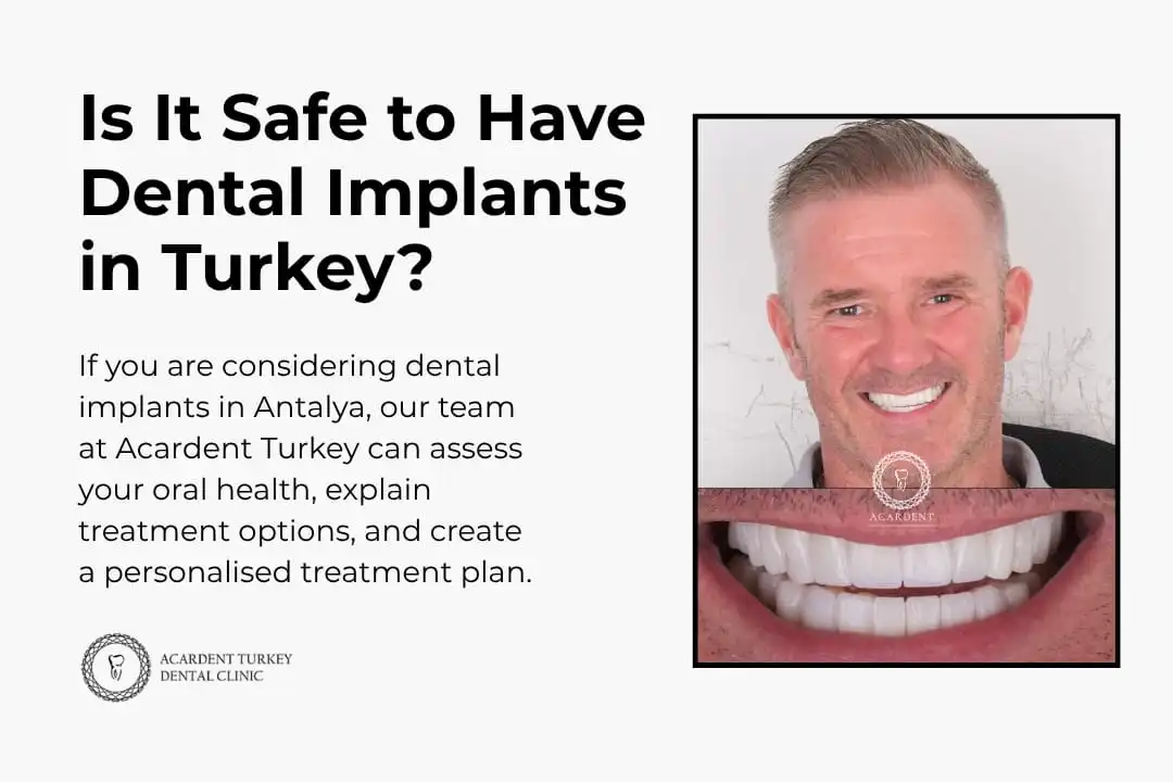 Is It Safe to Have Dental Implants in Turkey? - Acardent Turkey