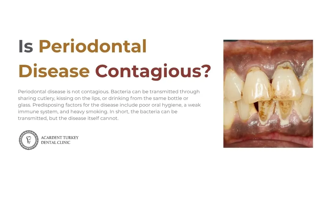 Is periodontal disease contagious?