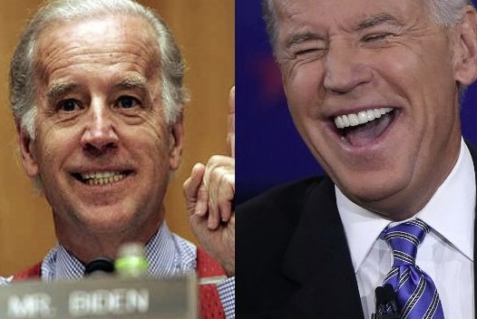 Joe Biden celebrity veneers before and after Antalya, Turkey