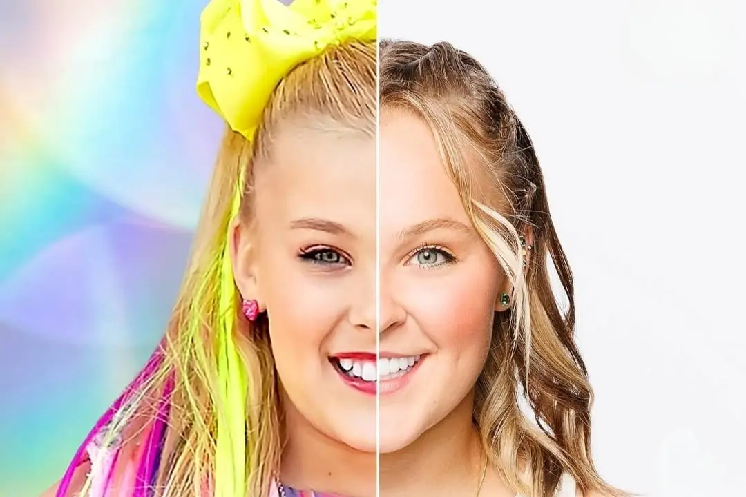 JoJo Siwa teeth veneer before and after Antalya, Turkey