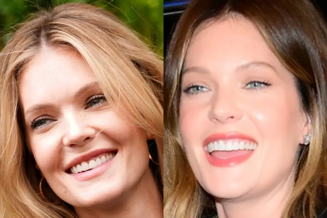 Meghann Fahy teeth Antalya, Turkey