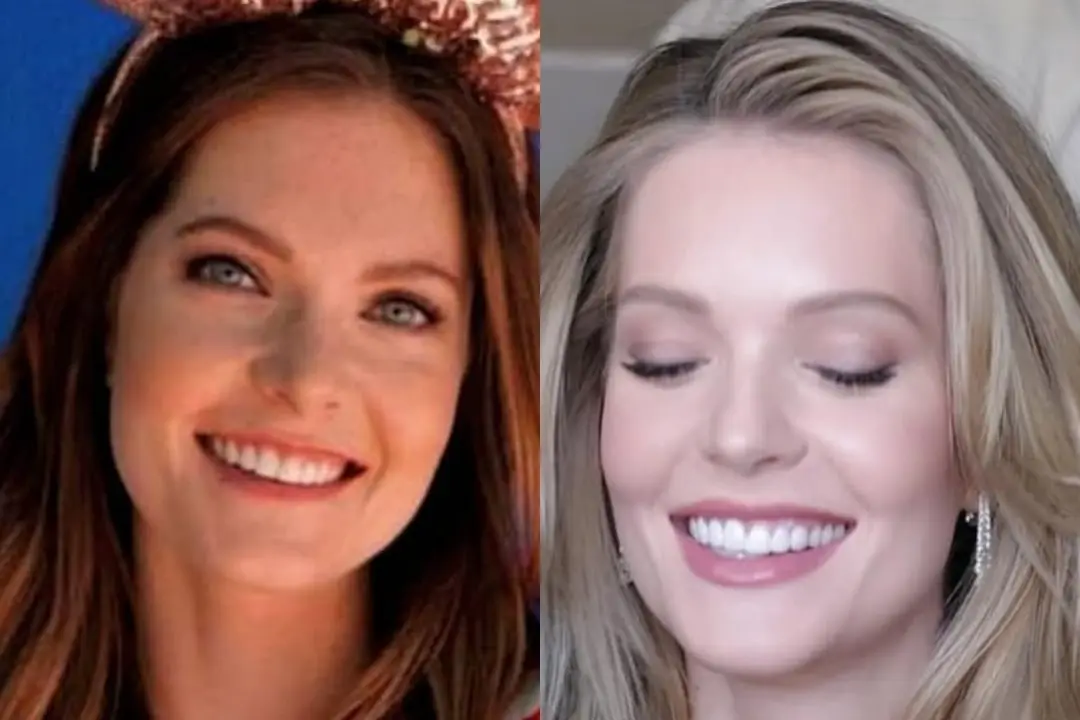 Meghann Fahy teeth Antalya, Turkey