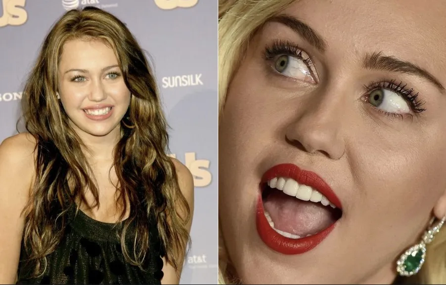 Miley Cyrus Teeth Antalya Turkey