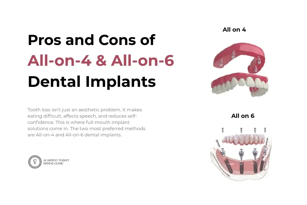 Zirconia Dental Implants Turkey Antalya