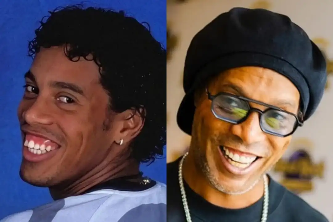 What are the differences between Ronaldinho's old and new teeth?