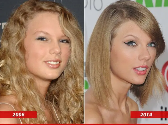Taylor Swift dental crown teeth before after Turkey