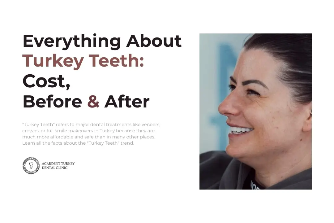 Turkey Teeth