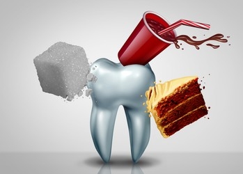  What causes cavities? Dental Clinic Antalya?