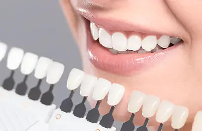 Porcelain Dental Veneers